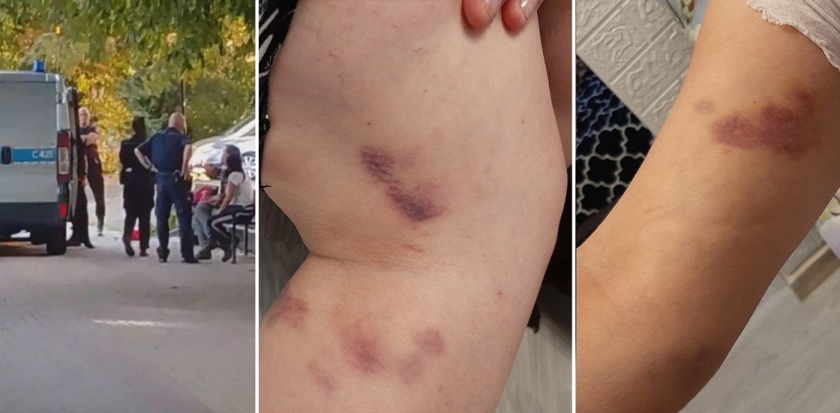 "Otworzyła piwo w parku" i TAK SKOŃCZYŁA. Policjanci byli zbyt brutalni? Komendant kazał to wyjaśnić